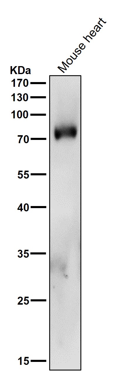 1 - Anti-PKC delta + PKC theta Rabbit Monoclonal Antibody ABO16706