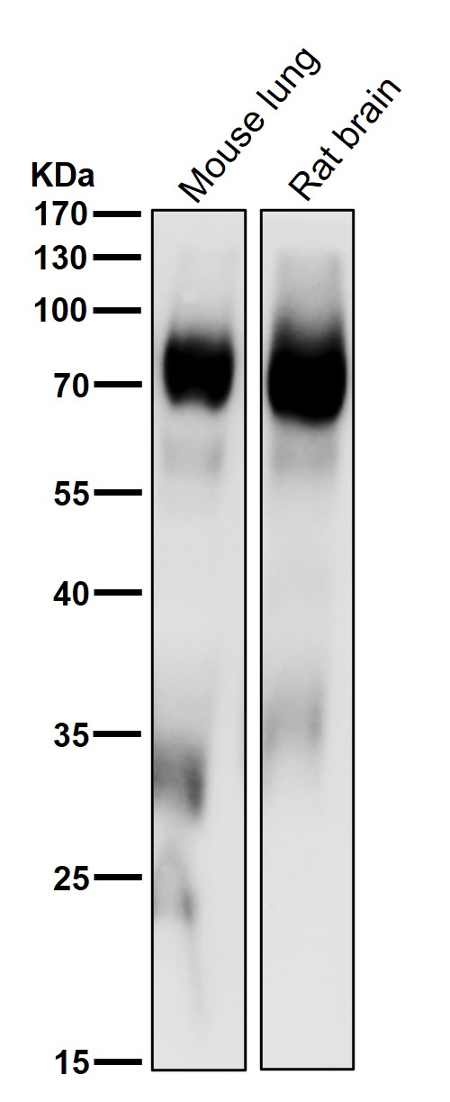 1 - Anti-PKC delta + PKC theta Rabbit Monoclonal Antibody ABO16706