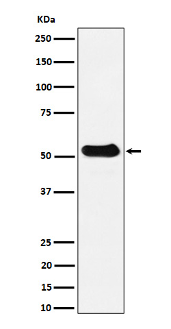 1 - Anti-alpha Tubulin (acetyl K40) Rabbit Monoclonal Antibody ABO16708
