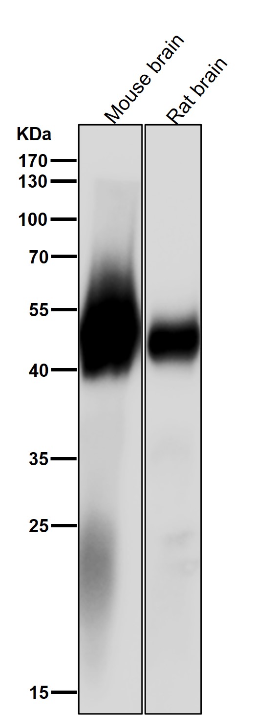 1 - Anti-alpha Tubulin (acetyl K40) Rabbit Monoclonal Antibody ABO16708