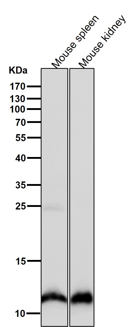 1 - Anti-Histone H4 (mono methyl K20) Rabbit Monoclonal Antibody ABO16710