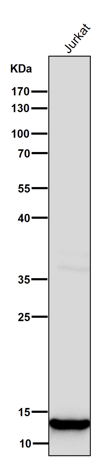 1 - Anti-Histone H4 (mono methyl K20) Rabbit Monoclonal Antibody ABO16710