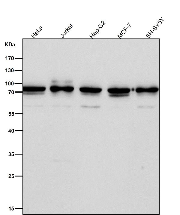 1 - Anti-Apc6 / CDC16 Rabbit Monoclonal Antibody ABO16715