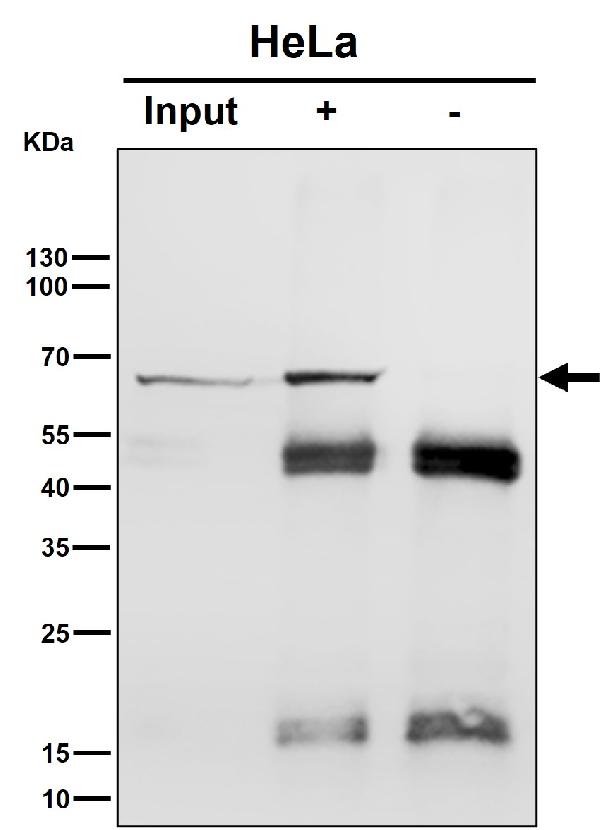 1 - Anti-Hsp70 Rabbit Monoclonal Antibody ABO16716