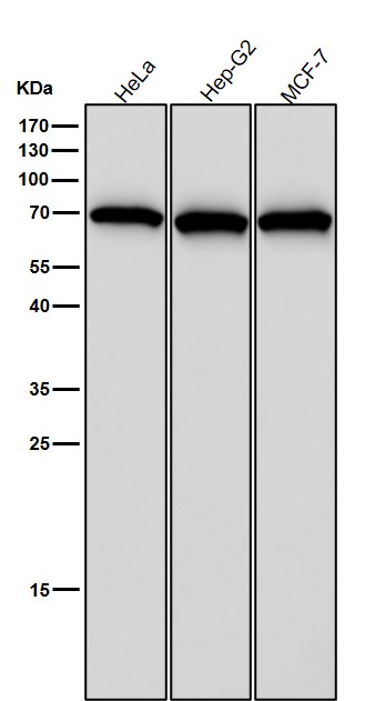 1 - Anti-Hsp70 Rabbit Monoclonal Antibody ABO16716