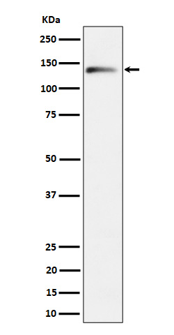 1 - Anti-delta 2 Catenin Rabbit Monoclonal Antibody ABO16718