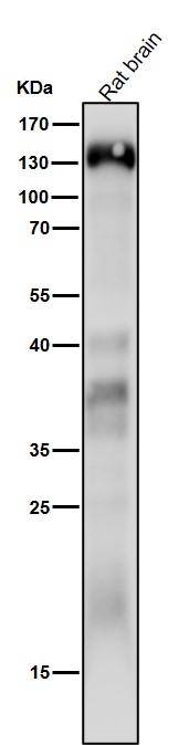 1 - Anti-delta 2 Catenin Rabbit Monoclonal Antibody ABO16718