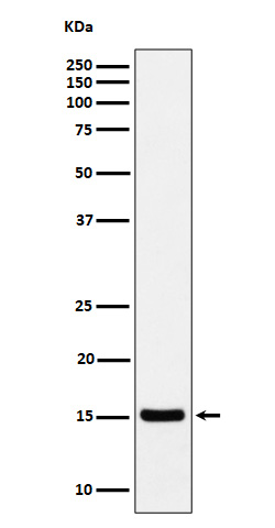 1 - Anti-Histone H3 (acetyl K36) Rabbit Monoclonal Antibody ABO16719