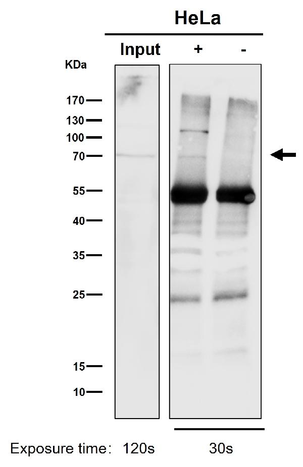 1 - Anti-PKC Rabbit Monoclonal Antibody ABO16720