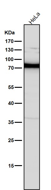 1 - Anti-PKC Rabbit Monoclonal Antibody ABO16720
