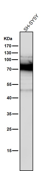 1 - Anti-PKC Rabbit Monoclonal Antibody ABO16720