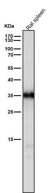 1 - Anti-Caspase-6 Rabbit Monoclonal Antibody ABO16722