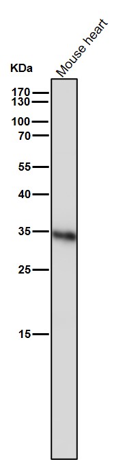 1 - Anti-Caspase-6 Rabbit Monoclonal Antibody ABO16722