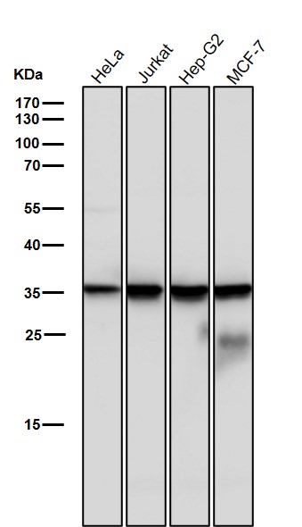 1 - Anti-Caspase-6 Rabbit Monoclonal Antibody ABO16722
