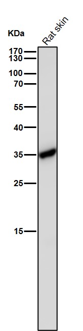1 - Anti-Caspase-6 Rabbit Monoclonal Antibody ABO16722