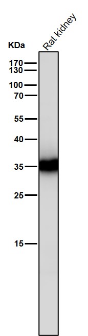 1 - Anti-Caspase-6 Rabbit Monoclonal Antibody ABO16722