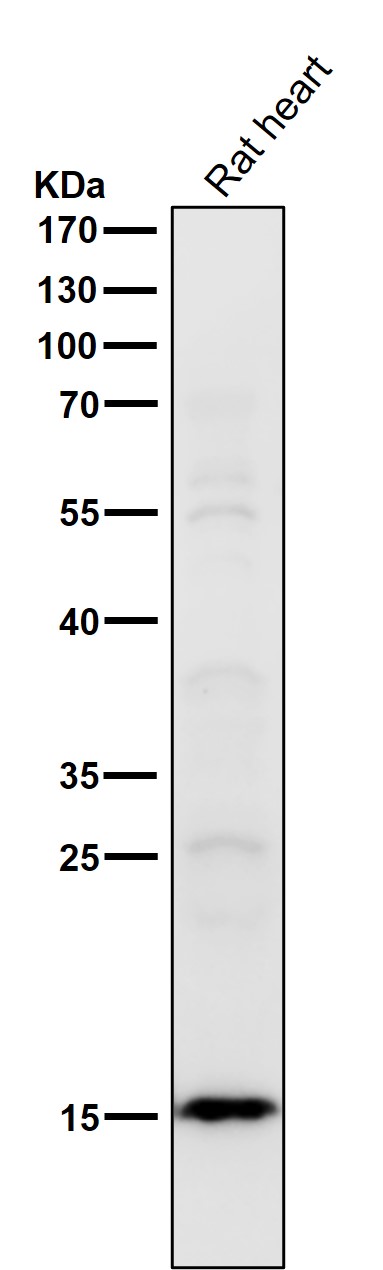 1 - Anti-Histone H2B (acetyl K16) Rabbit Monoclonal Antibody ABO16725