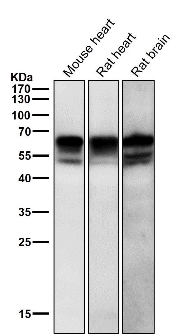 1 - Anti-Phospho-Src (Y529) Rabbit Monoclonal Antibody ABO16730
