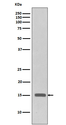 1 - Anti-Histone H3 (tri methyl K27) Rabbit Monoclonal Antibody ABO16731