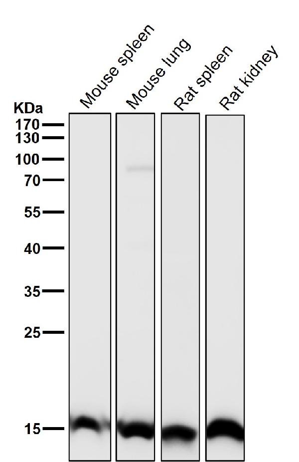1 - Anti-Histone H3 (tri methyl K27) Rabbit Monoclonal Antibody ABO16731
