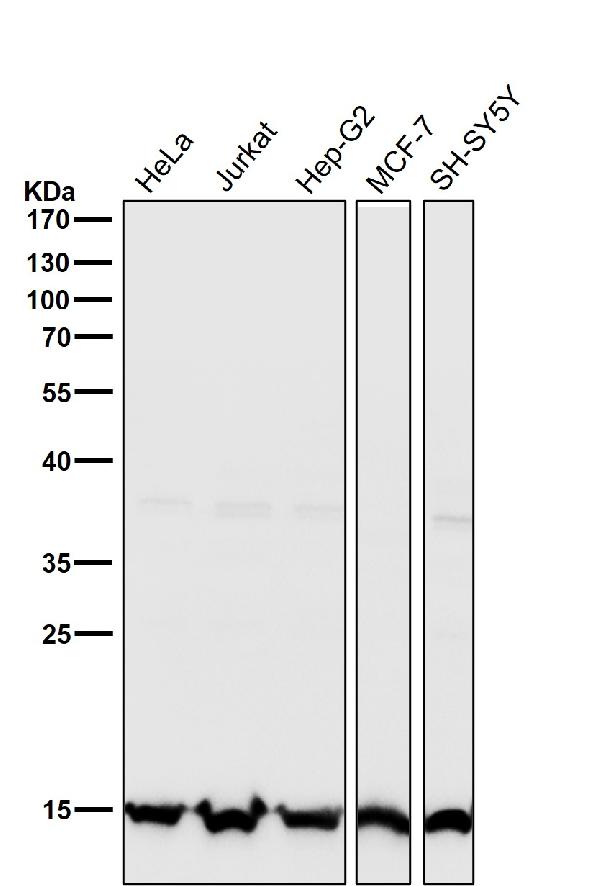 1 - Anti-Histone H3 (tri methyl K27) Rabbit Monoclonal Antibody ABO16731