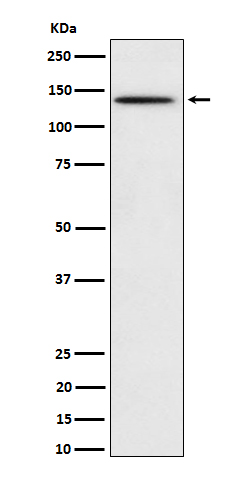 1 - Anti-Phospho-BCAR1 (Y410) Rabbit Monoclonal Antibody ABO16732