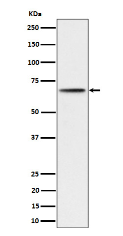 1 - Anti-Phospho-P70 S6 Kinase beta (S371) Rabbit Monoclonal Antibody ABO16733
