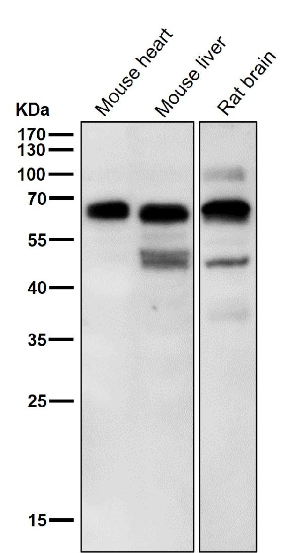 1 - Anti-Phospho-P70 S6 Kinase beta (S371) Rabbit Monoclonal Antibody ABO16733