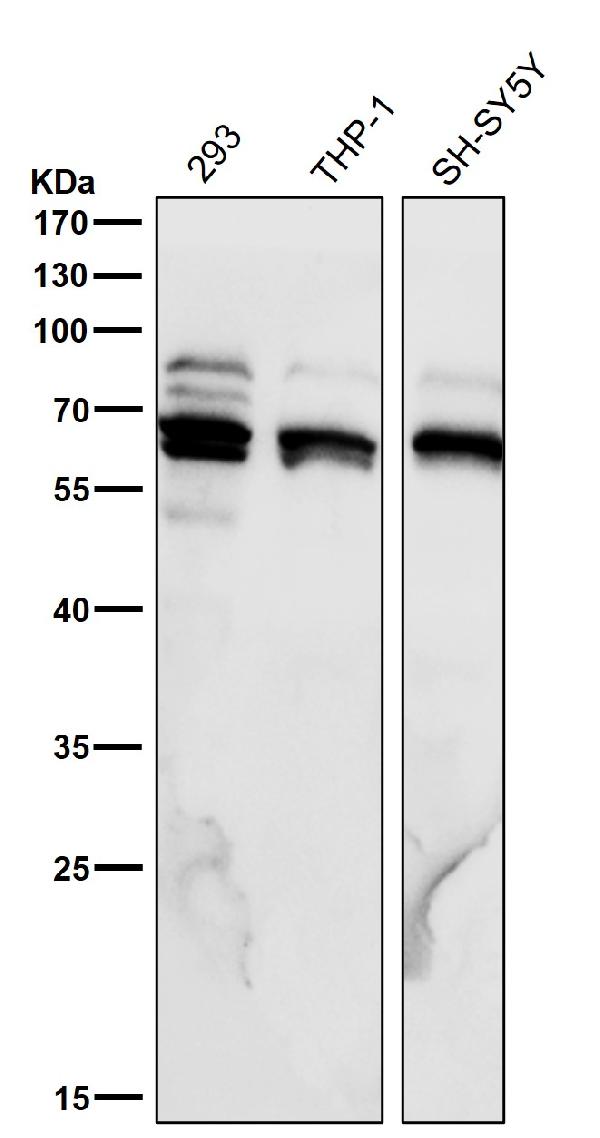 1 - Anti-Phospho-P70 S6 Kinase beta (S371) Rabbit Monoclonal Antibody ABO16733