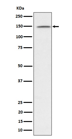1 - Anti-phospho-Phospholipase C gamma 1/PLC-gamma-1 (Y1253) Rabbit Monoclonal Antibody ABO16734