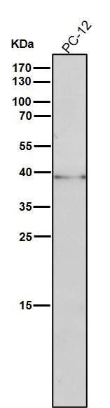 1 - Anti-Phospho-CrkL (Y207) Rabbit Monoclonal Antibody ABO16737