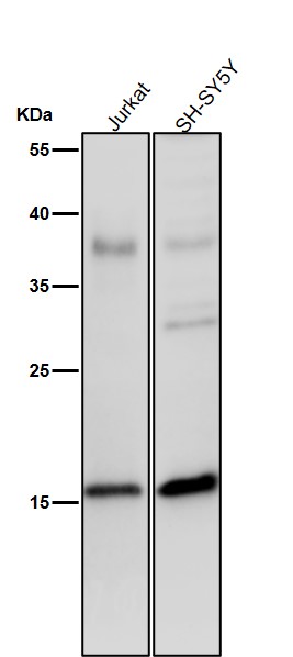 1 - Anti-Phospho-Histone H3 (S28) Rabbit Monoclonal Antibody ABO16738