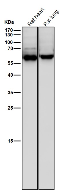 1 - Anti-Phospho-CRMP2 (T514) Rabbit Monoclonal Antibody ABO16739