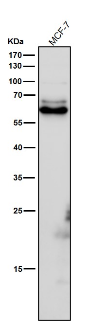1 - Anti-Phospho-CRMP2 (T514) Rabbit Monoclonal Antibody ABO16739
