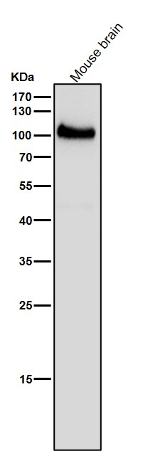 1 - Anti-USP5 Rabbit Monoclonal Antibody ABO16747