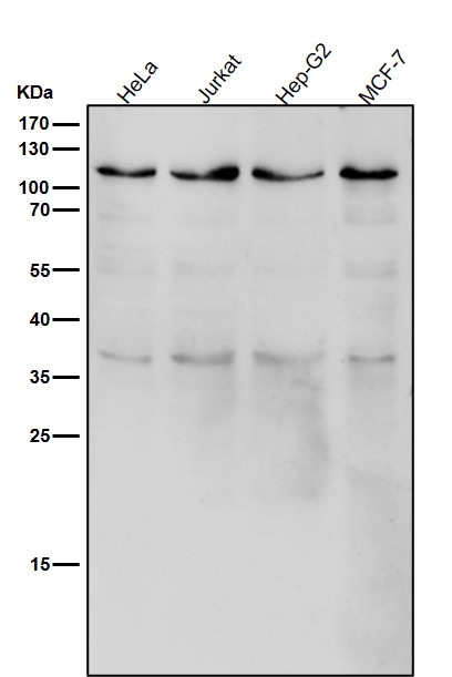 1 - Anti-USP5 Rabbit Monoclonal Antibody ABO16747