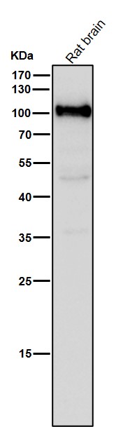 1 - Anti-USP5 Rabbit Monoclonal Antibody ABO16747