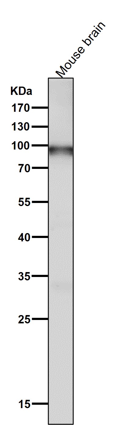 1 - Anti-UBF1 Rabbit Monoclonal Antibody ABO16749