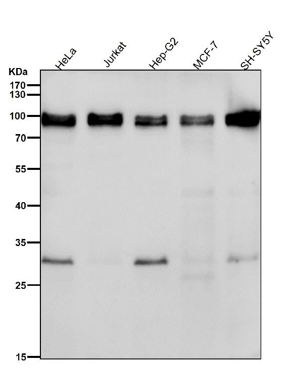 1 - Anti-UBF1 Rabbit Monoclonal Antibody ABO16749