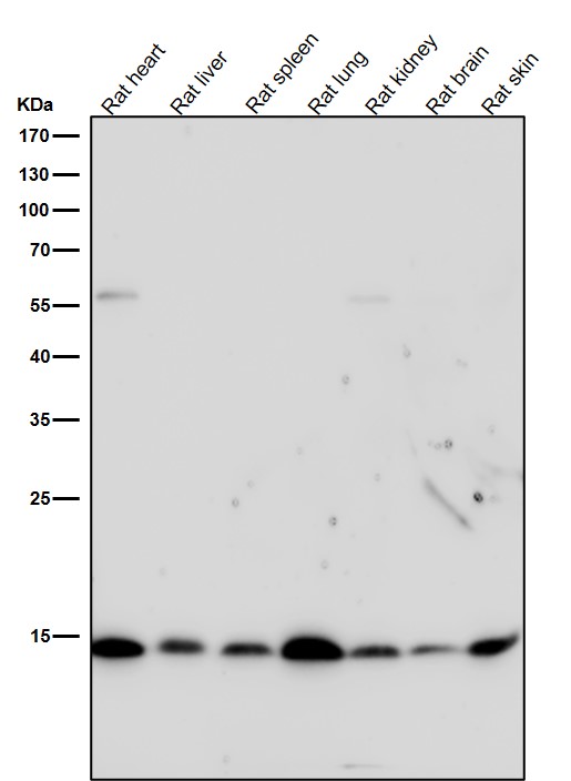 1 - Anti-Histone H3 (acetyl K9) Rabbit Monoclonal Antibody ABO16752