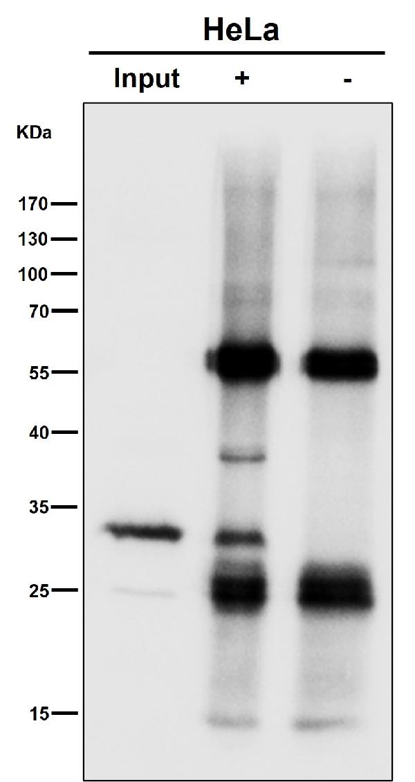 1 - Anti-SDHB Rabbit Monoclonal Antibody ABO16754