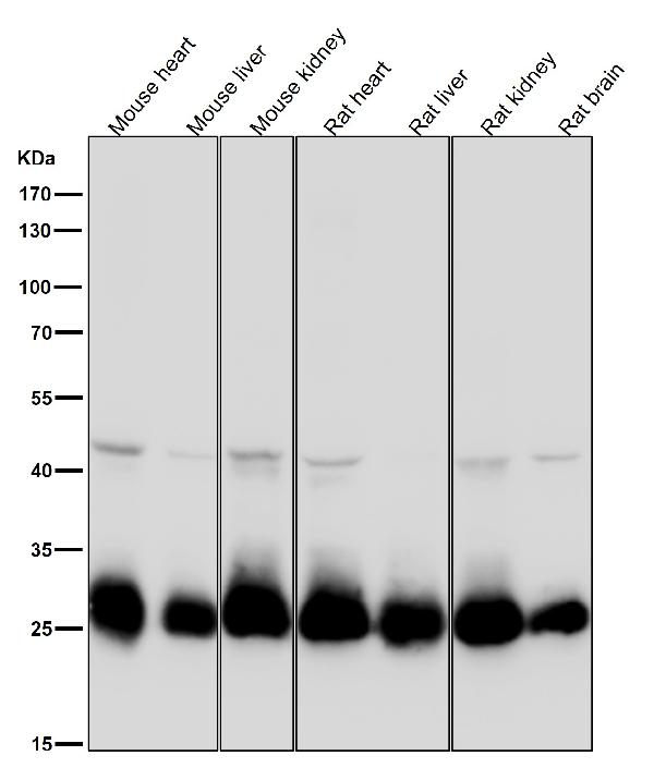 1 - Anti-SDHB Rabbit Monoclonal Antibody ABO16754