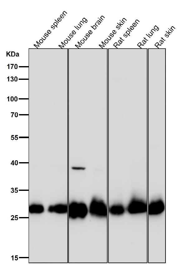 1 - Anti-SDHB Rabbit Monoclonal Antibody ABO16754