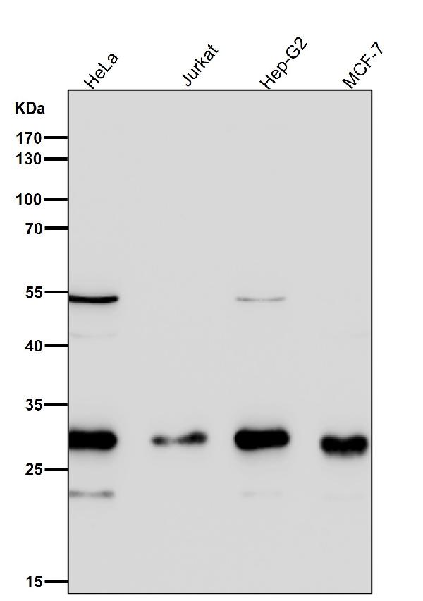 1 - Anti-SDHB Rabbit Monoclonal Antibody ABO16754