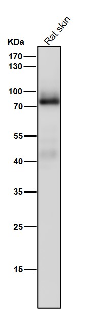 1 - Anti-PKC Rabbit Monoclonal Antibody ABO16757