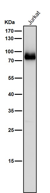 1 - Anti-PKC Rabbit Monoclonal Antibody ABO16757