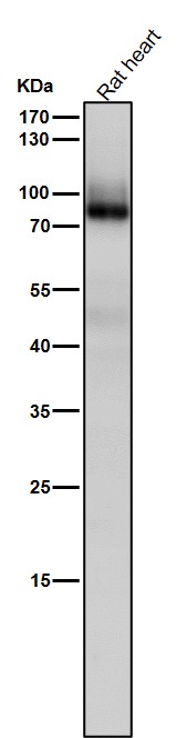 1 - Anti-PKC Rabbit Monoclonal Antibody ABO16757
