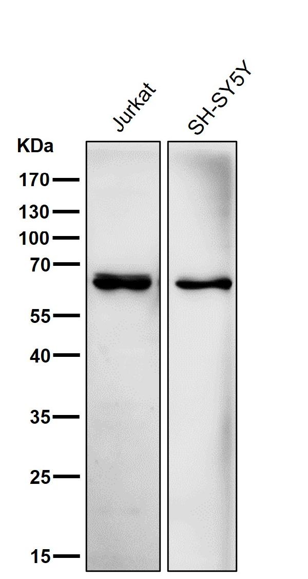 1 - Anti-ACADVL/VLCAD Rabbit Monoclonal Antibody ABO16760