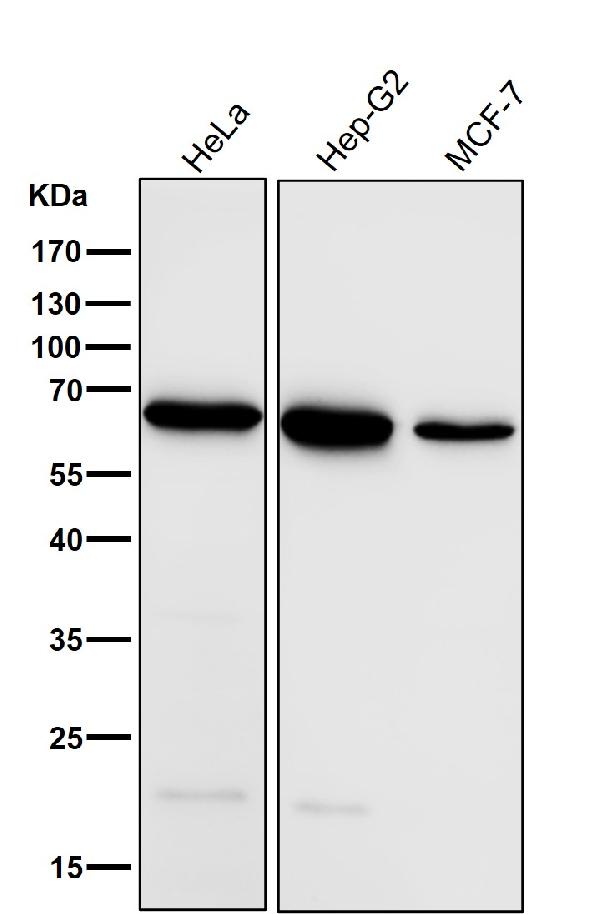 1 - Anti-ACADVL/VLCAD Rabbit Monoclonal Antibody ABO16760