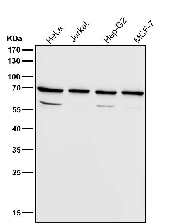 1 - Anti-Ribophorin I Rabbit Monoclonal Antibody ABO16761